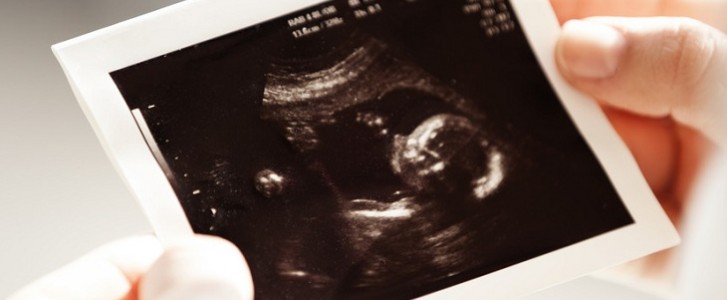 Woman's hands holding ultrasound pic