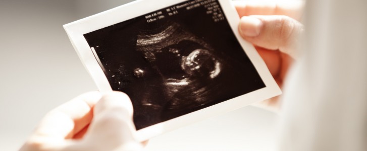 woman holding ultrasound picture